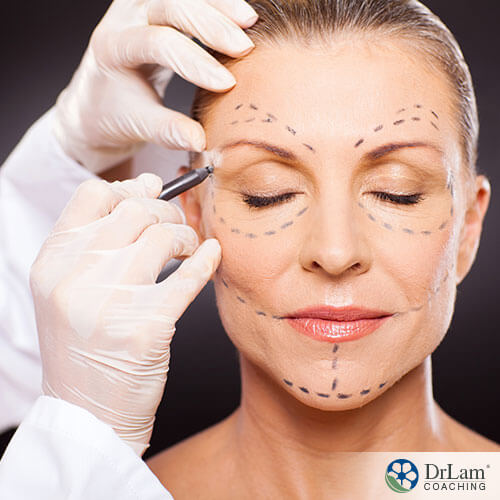 An image of a woman having lines drawn on her face in preparation of having cosmetic surgery