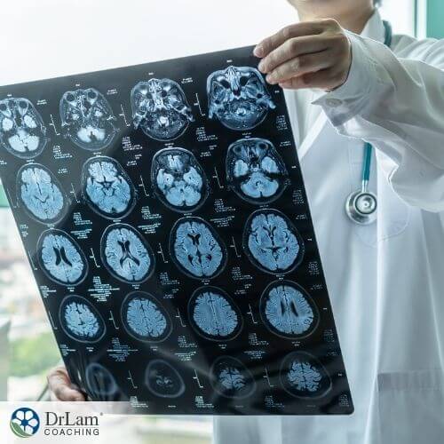 An image of a doctor holding up a brain scan
