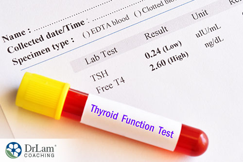red test tube with a note of the result from thyroid test