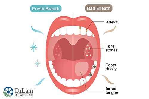 An image of a open mouth showing one side with good breath and one side having bad breath and all the causes
