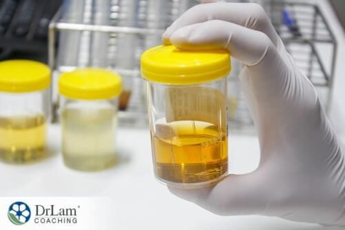 An image of orange urine in a sample bottle