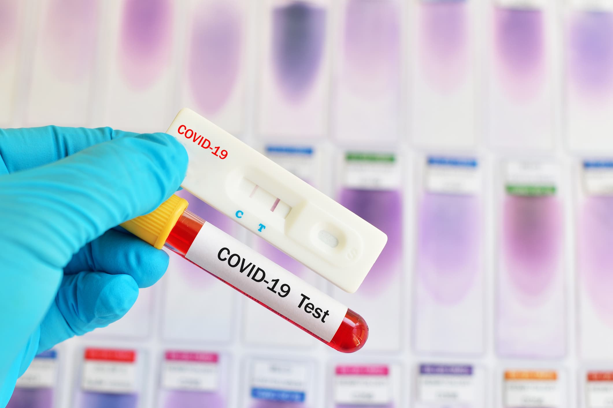 Что делают на тесте коронавируса. ПЦР-тестирование на Covid-19. Экспресс ПЦР тест. Тест Нако. Экспресс тестирование на коронавирус.